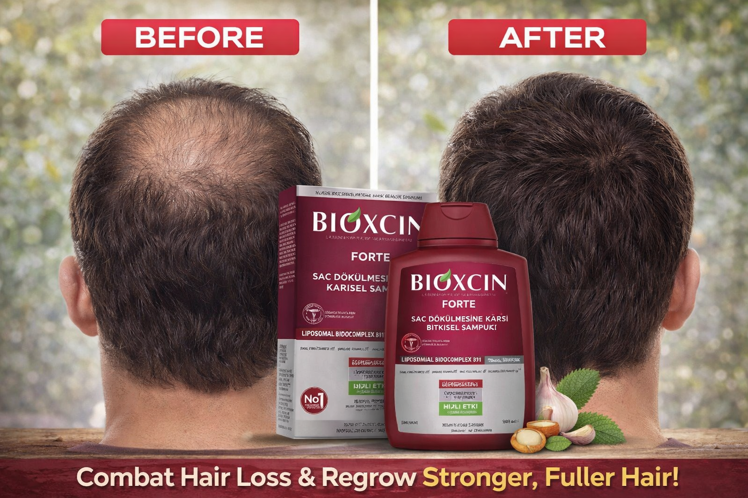 bioxin forte herbal shampoo for intense hair loss – 300 ml bioxin forte herbal shampoo for intense hair loss – 300 ml